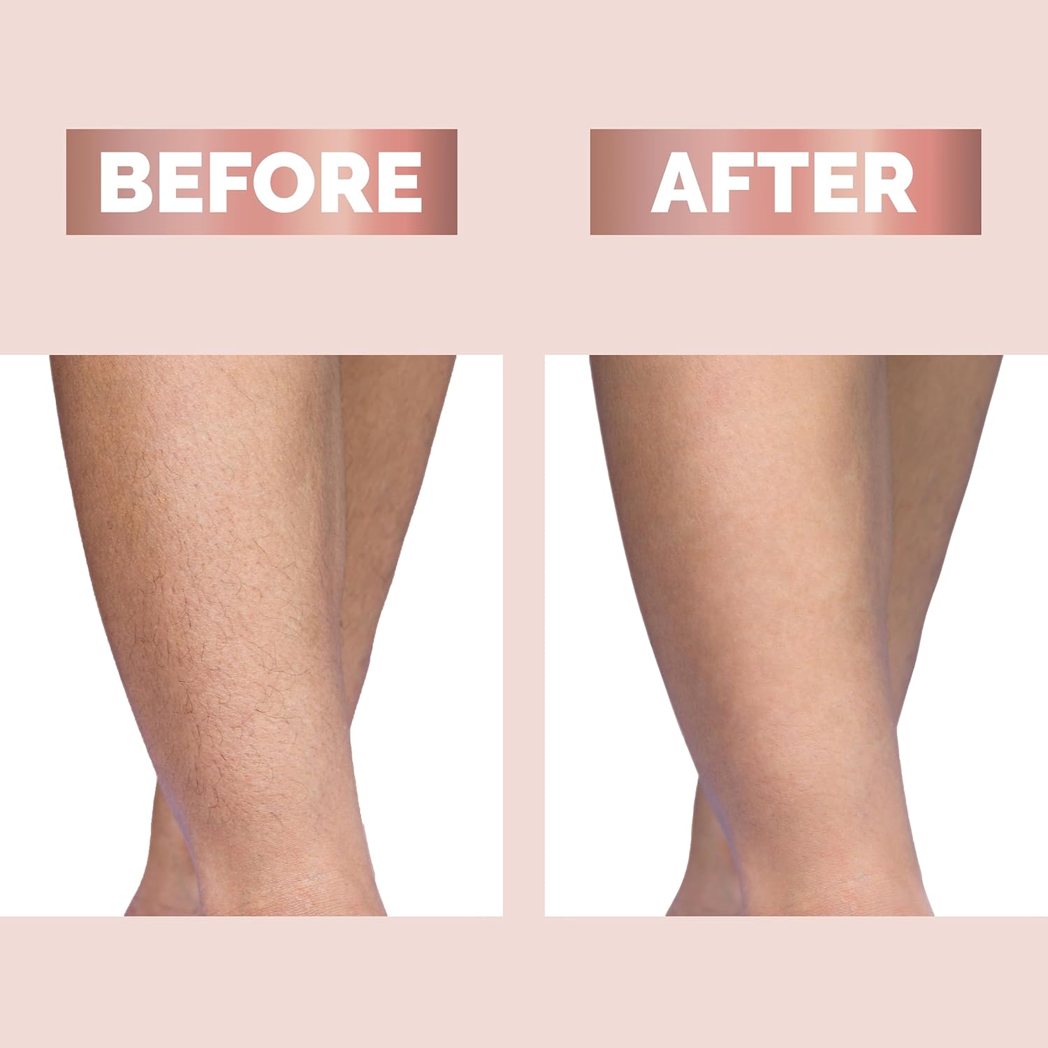 Finishing Touch Flawless Legs Hair Remover – Cordless & Rechargeable